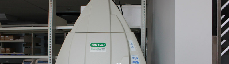 Gel Electrophoresis Imaging - Chemidoc MP (Biorad)